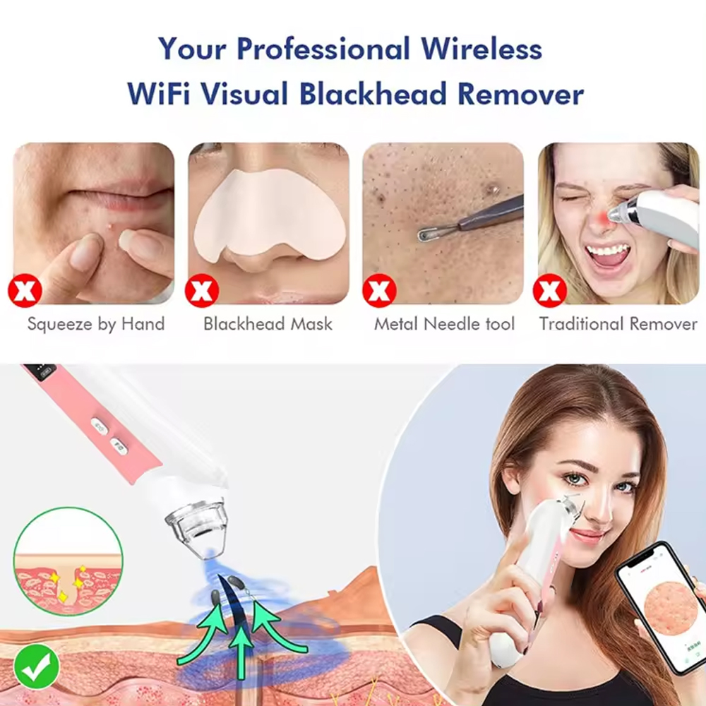 6 Heads Pore Cleaner Blackhead - Nasal Aspirator ulasan dan harga