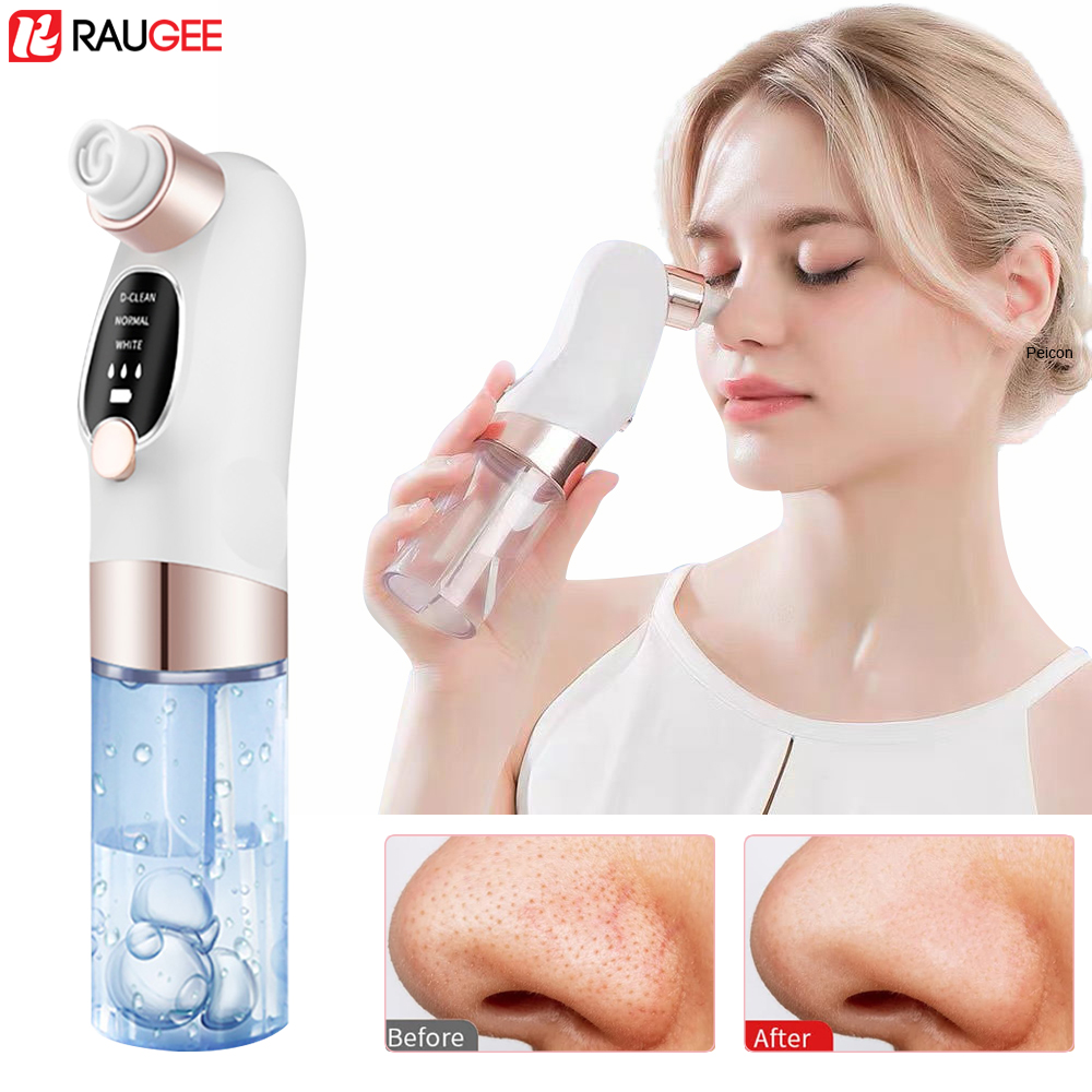 Blackhead Remover Electric Bla - Nasal Aspirator ulasan dan harga