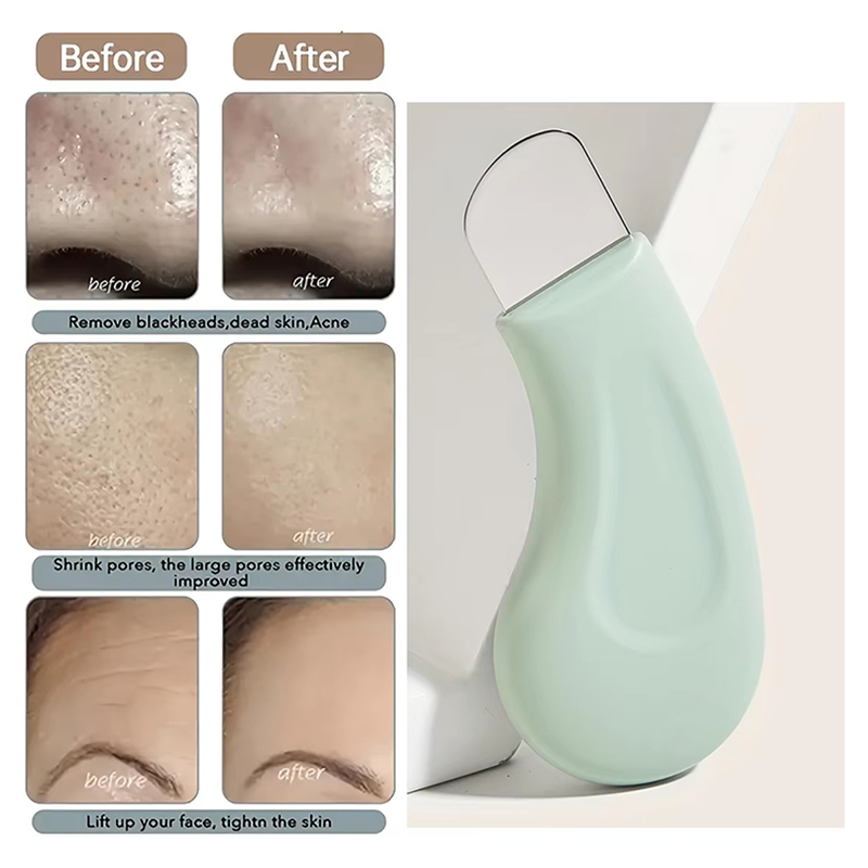Deep Cleansing Facial Blackhea - Nasal Aspirator ulasan dan harga